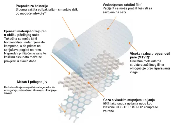 OPSITE POST-OP VISIBLE — 2