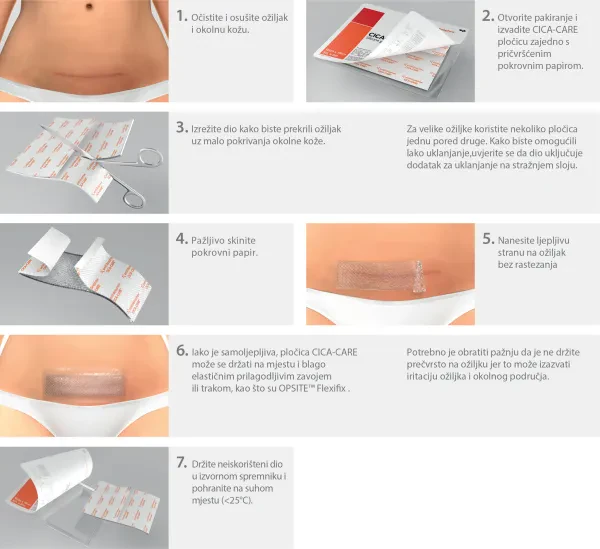 CICA-CARE — 3